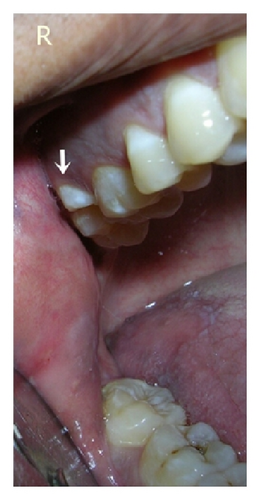Details are in the caption following the image