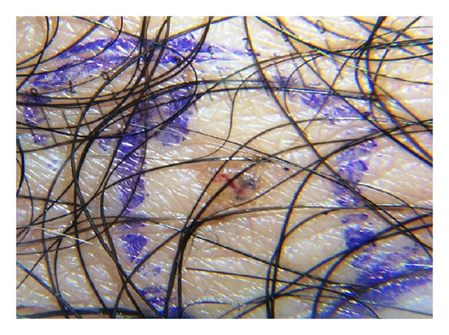 Details are in the caption following the image Details are in the caption following the image