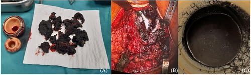 Details are in the caption following the image Details are in the caption following the image