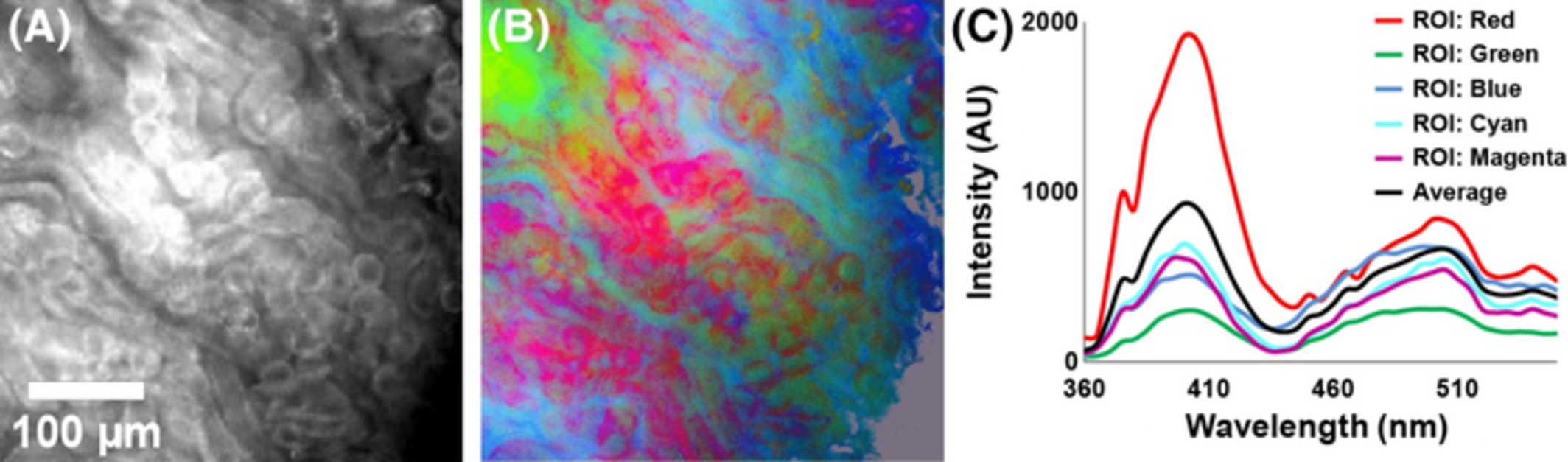 Label-free spectroscopic tissue characterization using fluorescence excitation-scanning spectral imaging