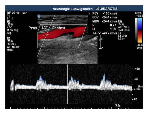 Details are in the caption following the image Details are in the caption following the image