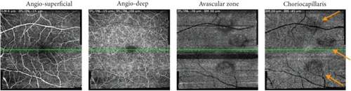 Details are in the caption following the image Details are in the caption following the image