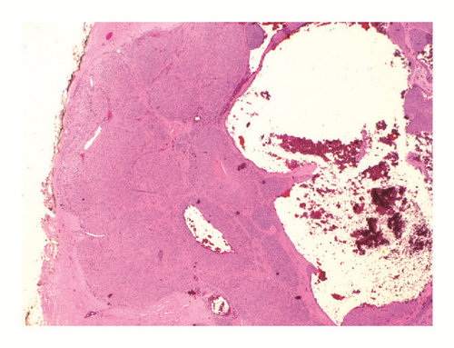 Details are in the caption following the image