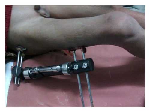 Details are in the caption following the image Details are in the caption following the image