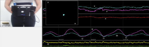 Normative values for gastric motility assessed with the 3D-transit electromagnetic tracking system