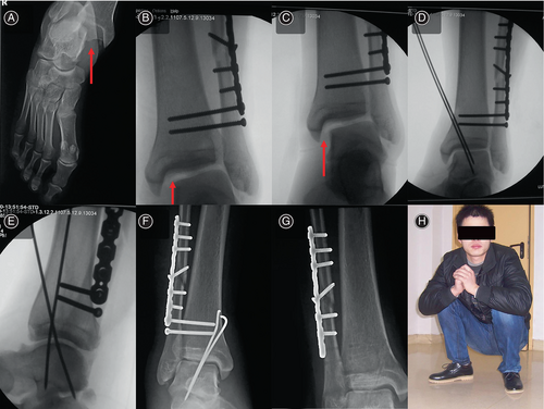 Details are in the caption following the image Details are in the caption following the image