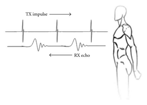 Details are in the caption following the image