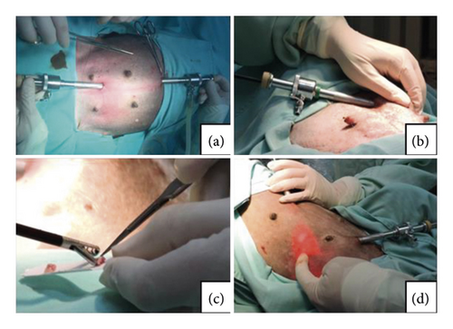 Details are in the caption following the image Details are in the caption following the image