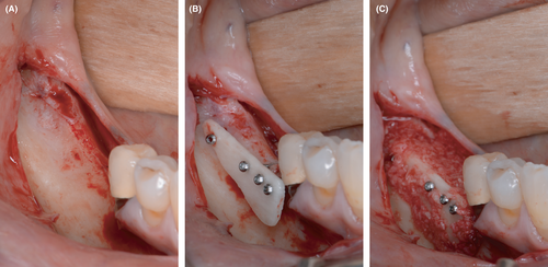 Details are in the caption following the image Details are in the caption following the image