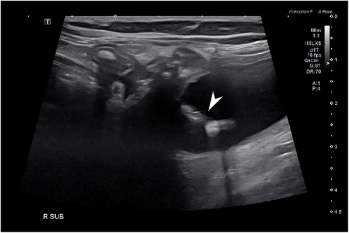 Details are in the caption following the image Details are in the caption following the image