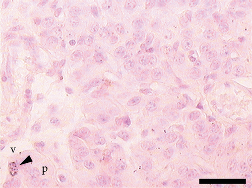 Details are in the caption following the image
