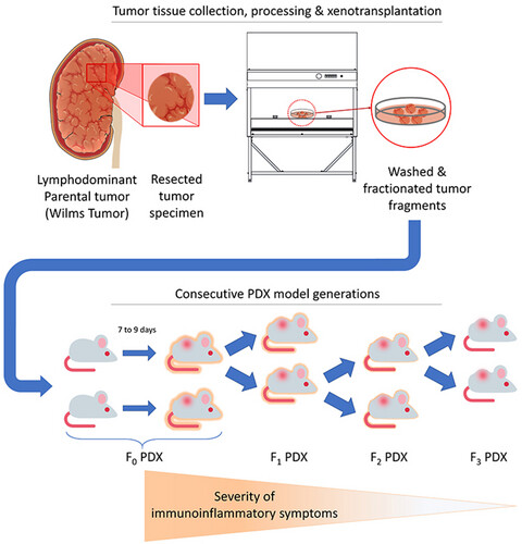 Spontaneous xenogeneic GvHD in Wilms' tumor Patient-Derived xenograft models and potential solutions