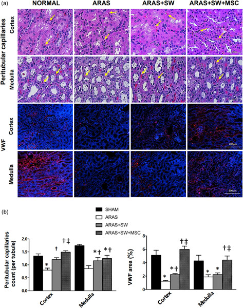 Adjunctive mesenchymal stem/stromal cells augment microvascular function in poststenotic kidneys treated with low-energy shockwave therapy