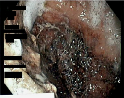 Details are in the caption following the image
