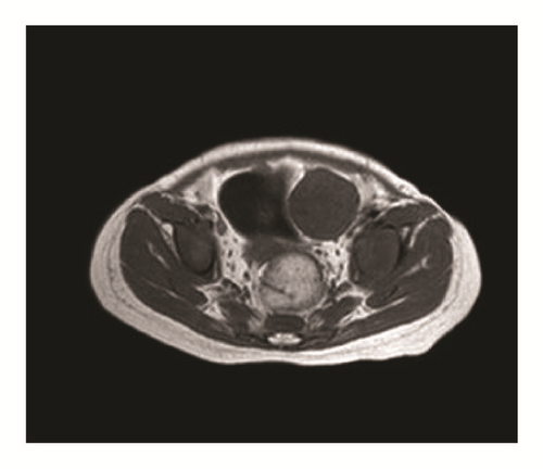 Details are in the caption following the image