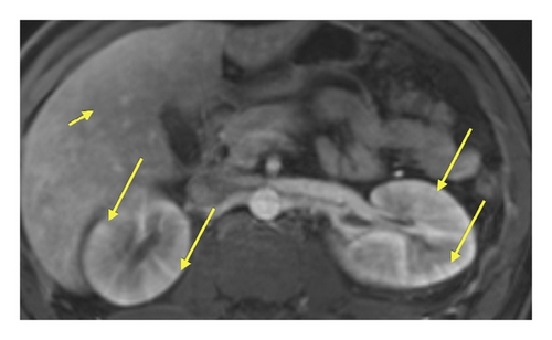 Details are in the caption following the image Details are in the caption following the image