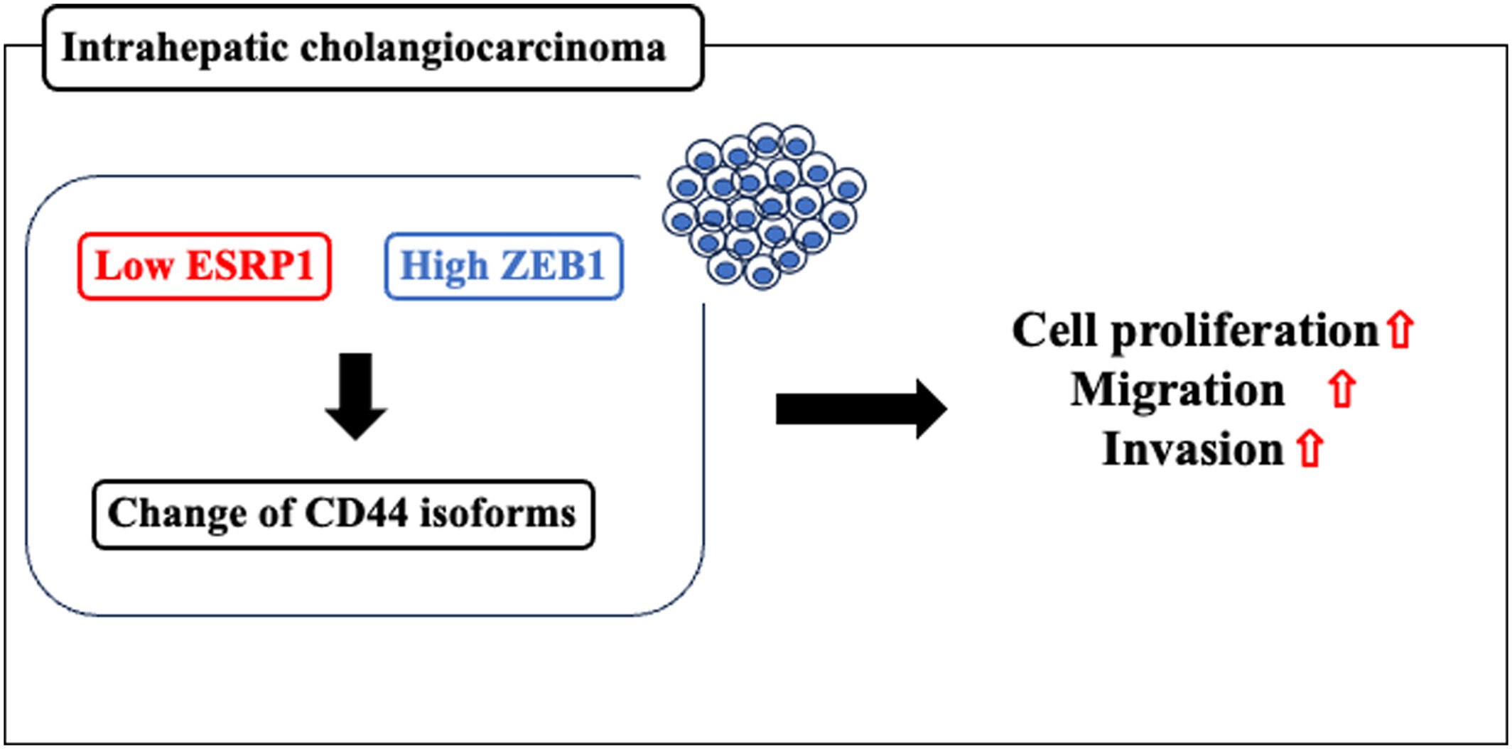 Molecular biological role of epithelial splicing regulatory protein 1 in intrahepatic cholangiocarcinoma