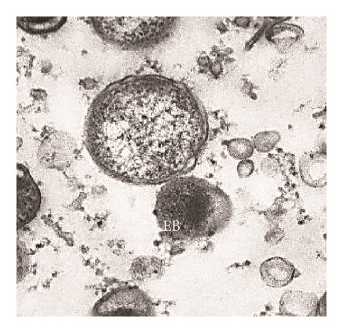 Details are in the caption following the image
