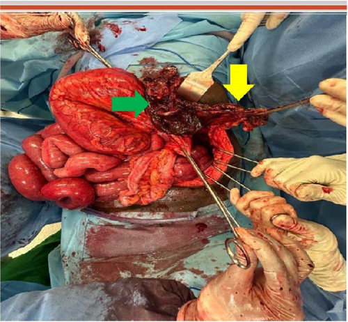 Details are in the caption following the image Details are in the caption following the image