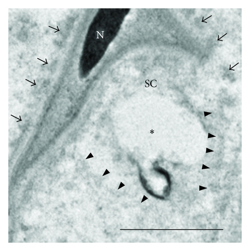 Details are in the caption following the image