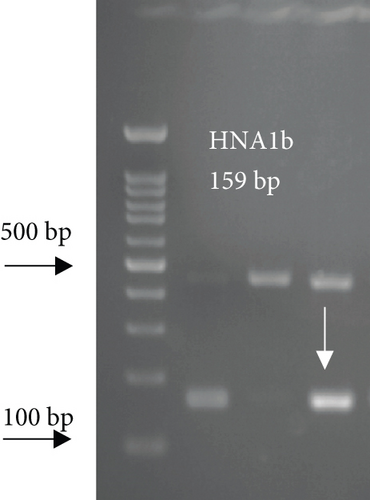 Details are in the caption following the image