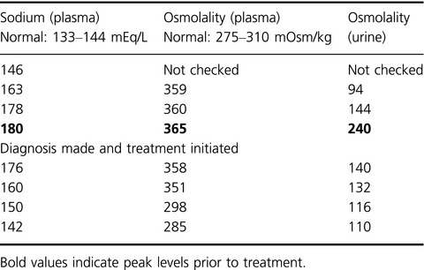 Diabetes insipidus uncovered during conservative management of complicated acute appendicitis