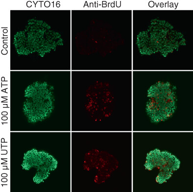 Amplified Ca2+ dynamics and accelerated cell proliferation in breast cancer tissue during purinergic stimulation