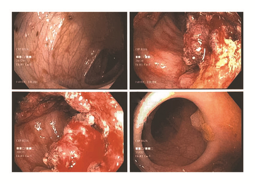 Details are in the caption following the image Details are in the caption following the image
