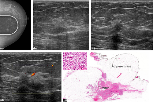 Details are in the caption following the image Details are in the caption following the image
