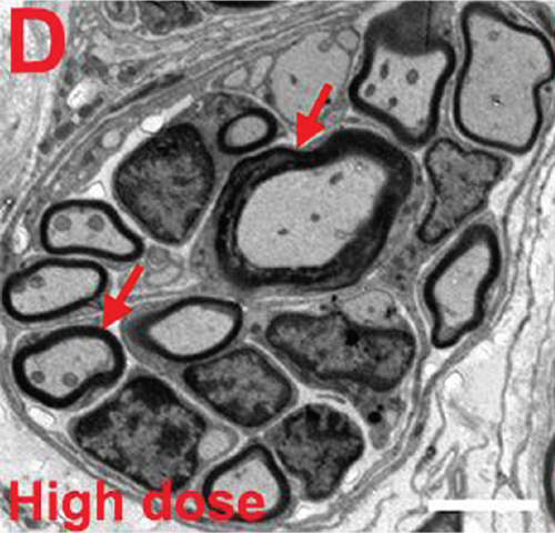 Details are in the caption following the image