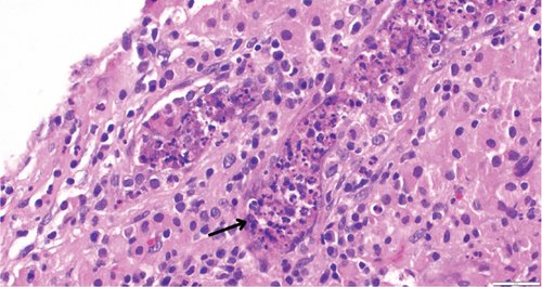 Details are in the caption following the image