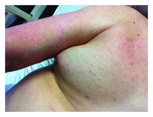 Details are in the caption following the image Details are in the caption following the image