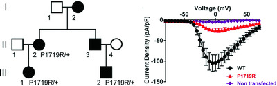 Partial loss-of-function of sodium channel SCN8A in familial isolated myoclonus