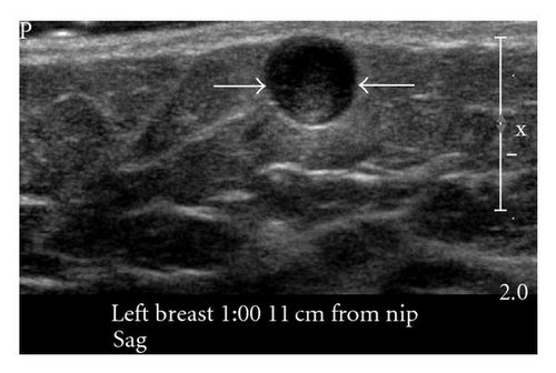 Details are in the caption following the image