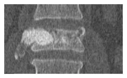 Details are in the caption following the image
