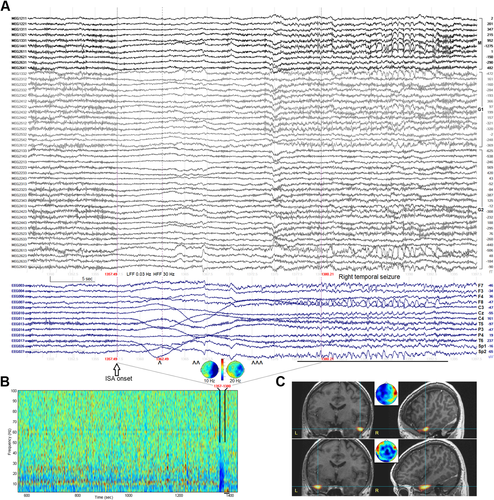 Details are in the caption following the image Details are in the caption following the image