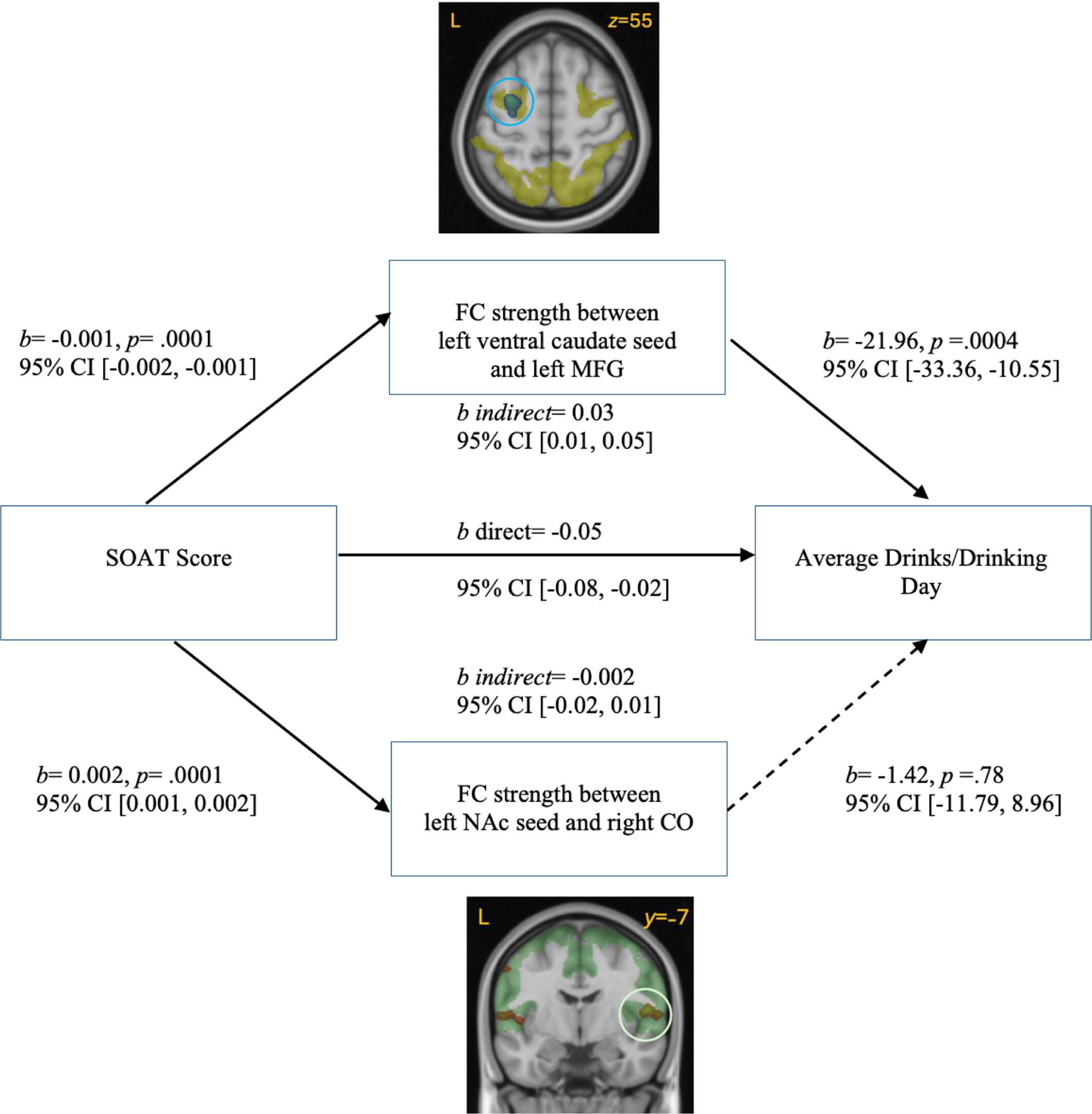 Left Ventral Caudate Functional Connectivity Mediates the Relationship Between Habitual Responding and Alcohol Use