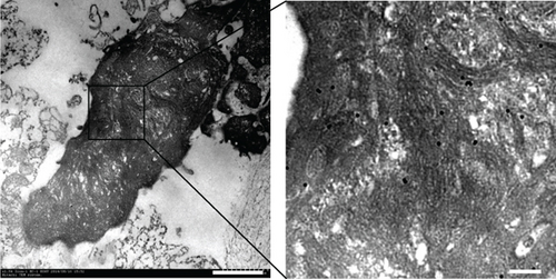 Details are in the caption following the image