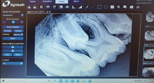 Details are in the caption following the image Details are in the caption following the image