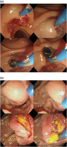 Details are in the caption following the image Details are in the caption following the image