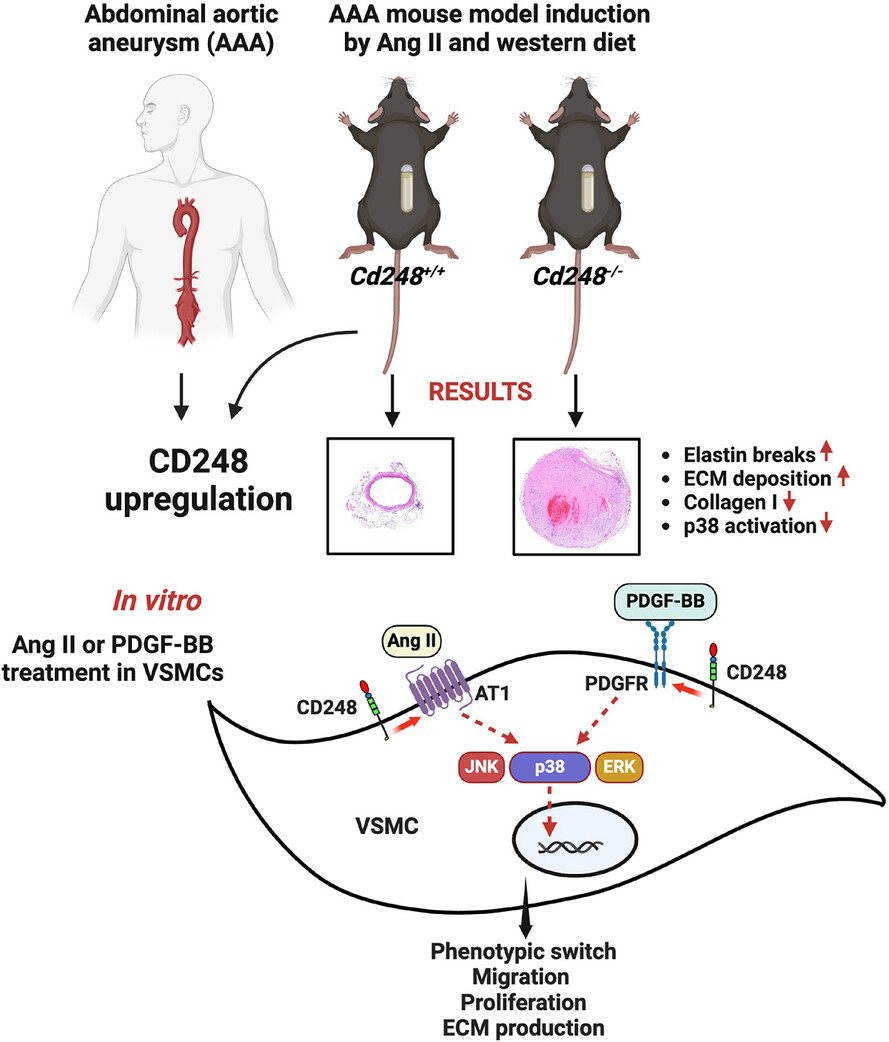 CD248 deficiency promotes angiotensin II-induced aortic lesion by attenuating receptor stability in smooth muscle cells