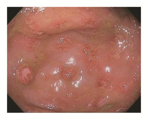 Details are in the caption following the image Details are in the caption following the image