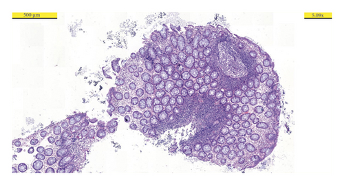 Details are in the caption following the image