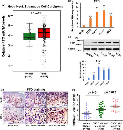 Fat mass and obesity-associated protein regulates tumorigenesis of arecoline-promoted human oral carcinoma