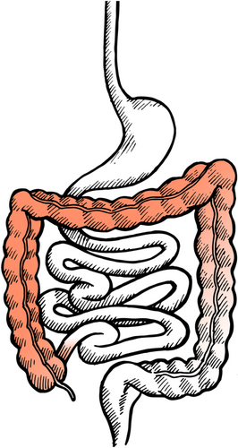 Details are in the caption following the image