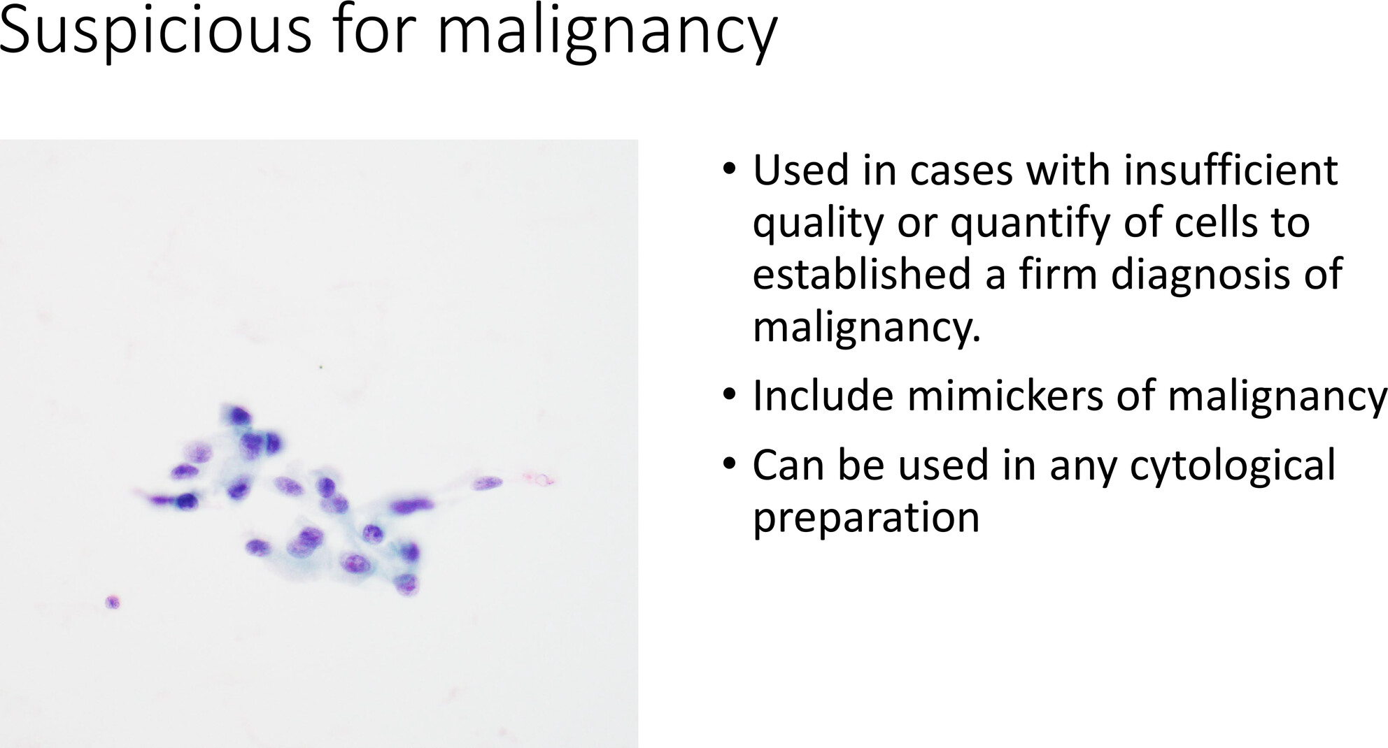 Diagnostic Category: Suspicious for Malignancy