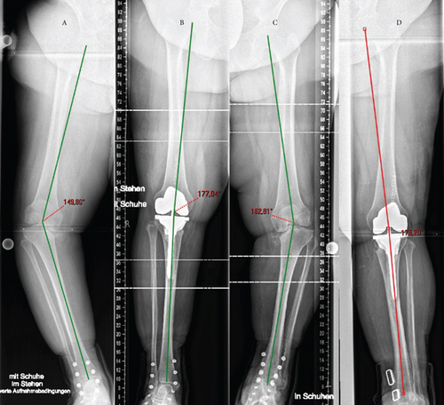 Details are in the caption following the image Details are in the caption following the image