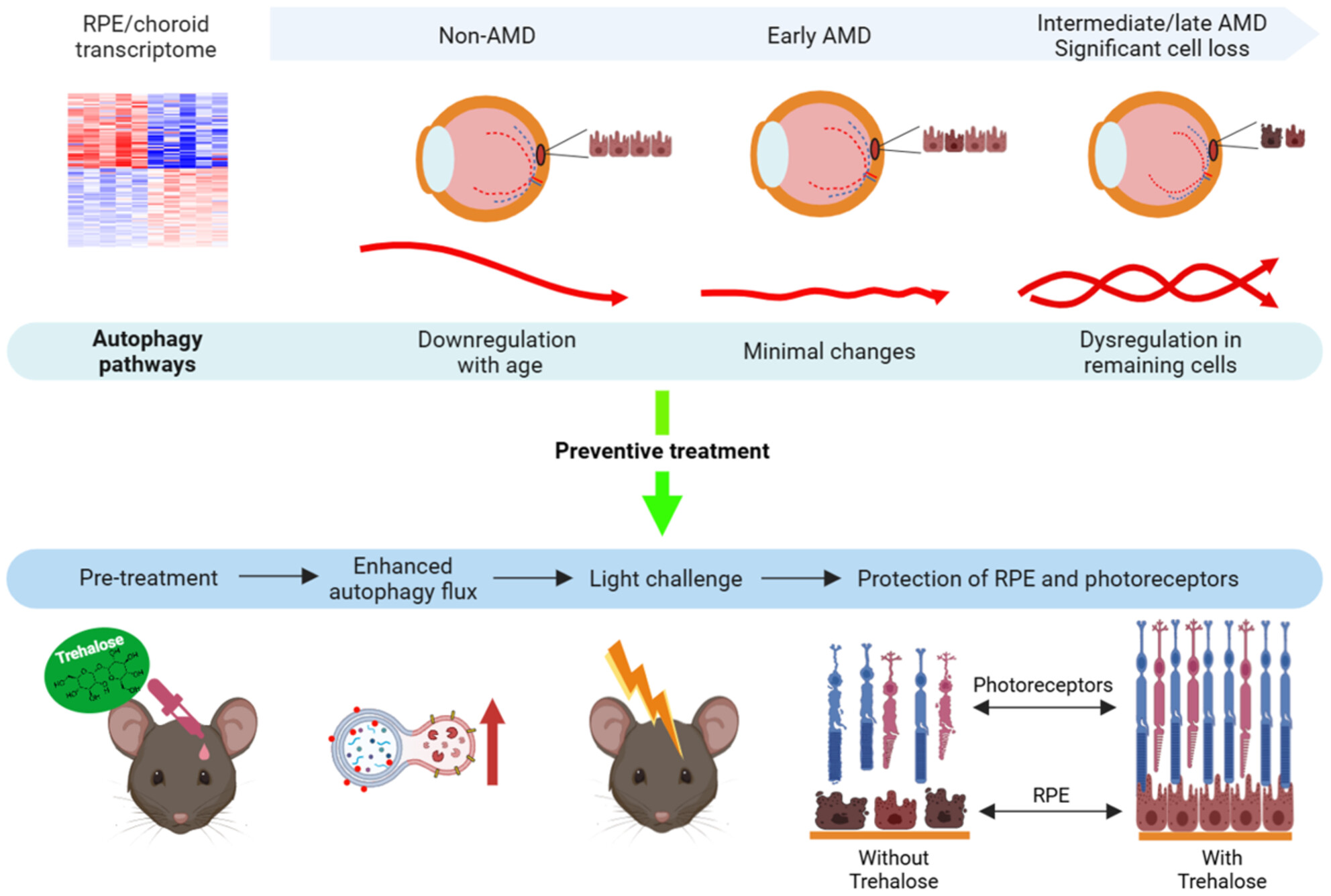 Age-Associated Decline in Autophagy Pathways in the Retinal Pigment Epithelium and Protective Effects of Topical Trehalose in Light-Induced Outer Retinal Degeneration in Mice