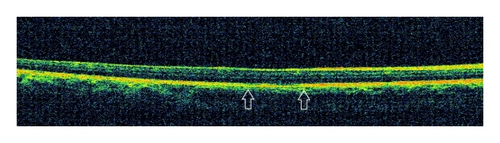 Details are in the caption following the image