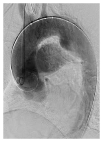 Details are in the caption following the image